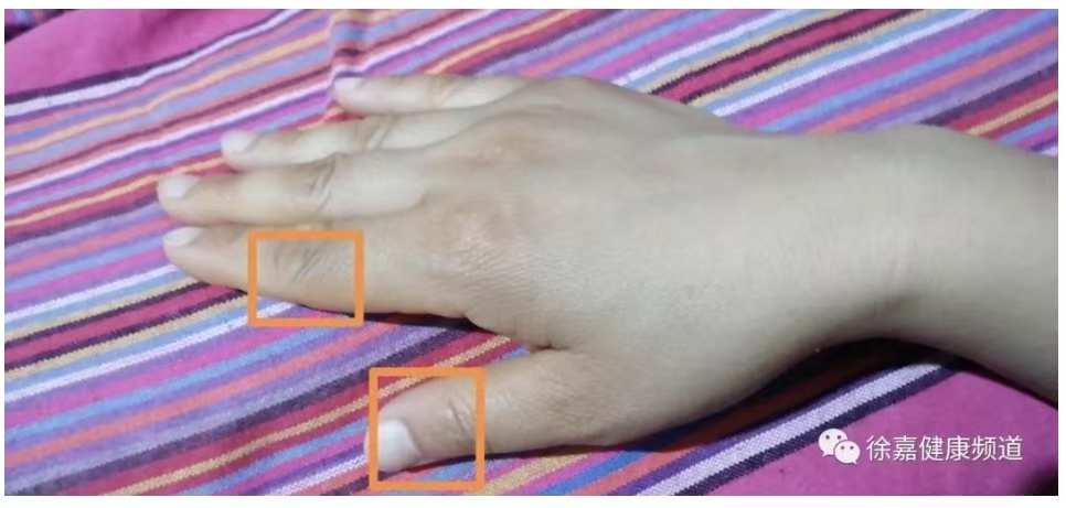 真不敢相信，只是改变日常饮食，我和母亲就战胜了糖尿病！-图片4